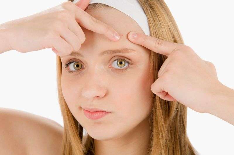 Мазь упокаивает кожу при акне, помогает предотвратить появление шрамов